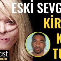 Facebook Takipçim Yüzüme Asit Attı | Katie Piper | Goalcast Türkiye