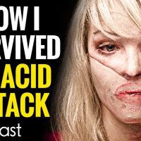 My Facebook Stalker Threw Acid In My Face | Katie Piper | Goalcast